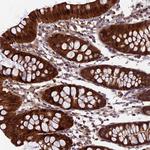 CCDC15 Polyclonal Antibody