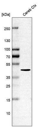 ITPKA Antibody in Western Blot (WB)