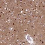 LYSMD2 Antibody in Immunohistochemistry (Paraffin) (IHC (P))