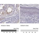 ACSL6 Polyclonal Antibody