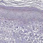 ACSL6 Antibody in Immunohistochemistry (IHC)