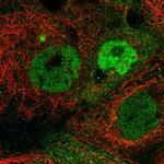 TMEM98 Polyclonal Antibody