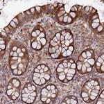 TMEM98 Antibody in Immunohistochemistry (Paraffin) (IHC (P))