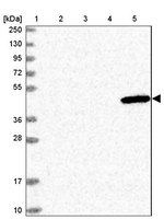 ULK3 Antibody in Western Blot (WB)