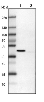 ULK3 Antibody in Western Blot (WB)