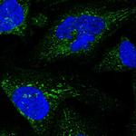 GLCE Polyclonal Antibody
