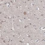GLCE Antibody in Immunohistochemistry (Paraffin) (IHC (P))