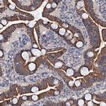 GLCE Antibody in Immunohistochemistry (Paraffin) (IHC (P))