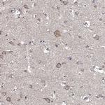 GLCE Antibody in Immunohistochemistry (IHC)
