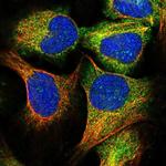 C15orf52 Polyclonal Antibody