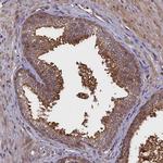 RBFA Polyclonal Antibody