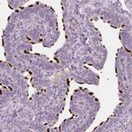 FAM154B Antibody in Immunohistochemistry (IHC)
