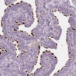 FAM154B Antibody in Immunohistochemistry (IHC)