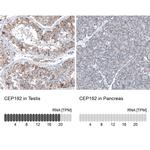 CEP192 Antibody in Immunohistochemistry (IHC)