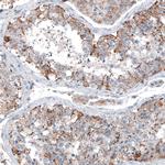 CEP192 Antibody in Immunohistochemistry (IHC)