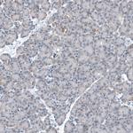 CEP192 Antibody in Immunohistochemistry (IHC)