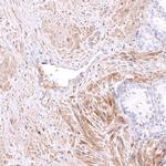 Kindlin 2 Antibody in Immunohistochemistry (Paraffin) (IHC (P))