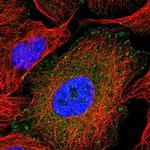 Kindlin 2 Antibody in Immunocytochemistry (ICC/IF)