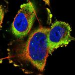 TMC3 Polyclonal Antibody