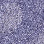 TMC3 Antibody in Immunohistochemistry (Paraffin) (IHC (P))