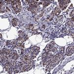 TMC3 Antibody in Immunohistochemistry (IHC)