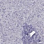 TMC3 Antibody in Immunohistochemistry (IHC)