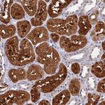 C11orf54 Polyclonal Antibody