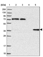 C11orf54 Antibody in Western Blot (WB)