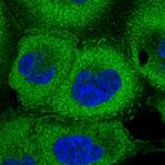 PSMD9 Polyclonal Antibody