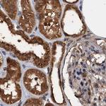 PSMD9 Antibody in Immunohistochemistry (IHC)