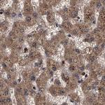 PSMD9 Antibody in Immunohistochemistry (IHC)