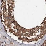 PSMD9 Antibody in Immunohistochemistry (IHC)