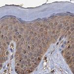 PSMD9 Antibody in Immunohistochemistry (IHC)