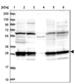 PSMD9 Antibody in Western Blot (WB)