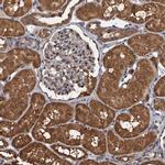 PSMD9 Antibody in Immunohistochemistry (IHC)