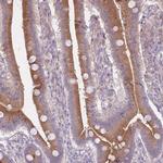 ARPIN Polyclonal Antibody