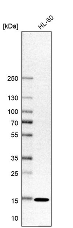 SNRPD1 Antibody in Western Blot (WB)