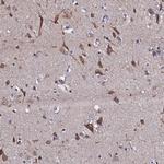 SLC16A14 Antibody in Immunohistochemistry (Paraffin) (IHC (P))