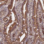 SLC16A14 Antibody in Immunohistochemistry (Paraffin) (IHC (P))