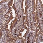 SLC16A14 Antibody in Immunohistochemistry (IHC)
