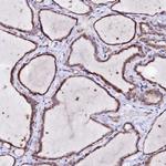 BTBD16 Polyclonal Antibody