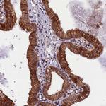 PLXNB1 Antibody in Immunohistochemistry (IHC)