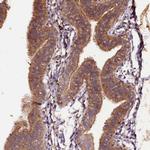 PLXNB1 Antibody in Immunohistochemistry (IHC)