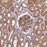 PLXNB1 Antibody in Immunohistochemistry (IHC)