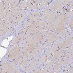 PLXNB1 Antibody in Immunohistochemistry (IHC)