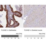 PLXNB1 Antibody