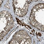 TPGS2 Polyclonal Antibody