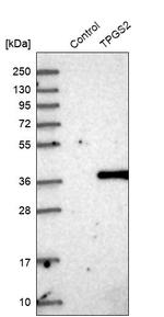 TPGS2 Antibody in Western Blot (WB)