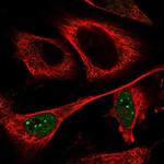 CCDC102A Antibody in Immunocytochemistry (ICC/IF)