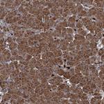 CCDC102A Antibody in Immunohistochemistry (Paraffin) (IHC (P))